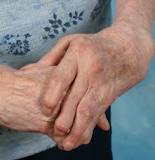 dolor mano presion guante artritis