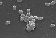 grave faecalis enterococcus